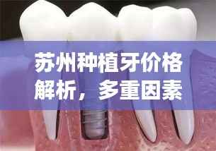 苏州种植牙价格解析,多重因素深度探讨
